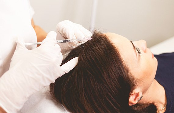 Mesoterapia Capilar