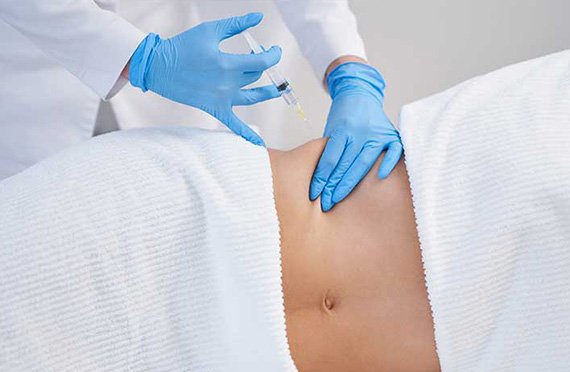 Mesoterapia Corporal